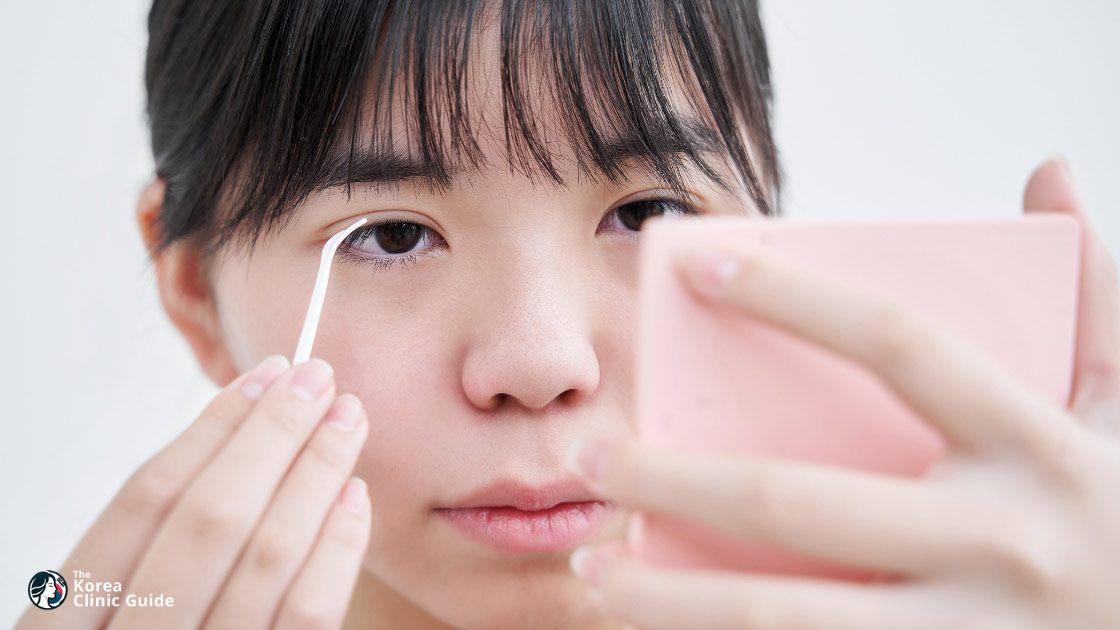 韓国の二重手術、埋没法 vs 切開法の違いは？リアル比較ガイド