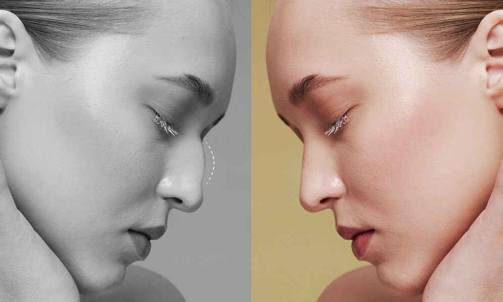 美容整形の修正・修復手術 — 失敗を正す韓国専門クリニックガイド